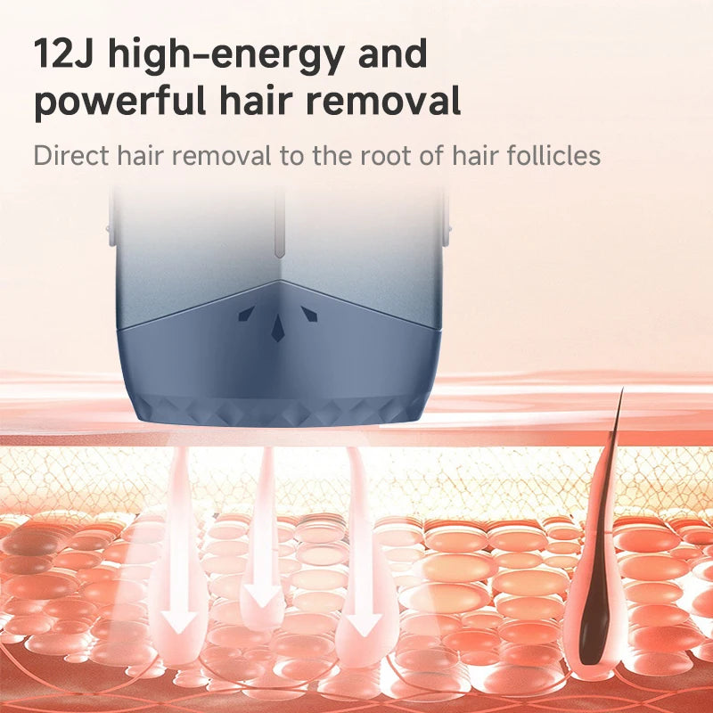 Mlay T18 Ice Cooling IPL Laser Hair Removal - Unlimited Flashes Permanent Painless Epilator for Women & Men