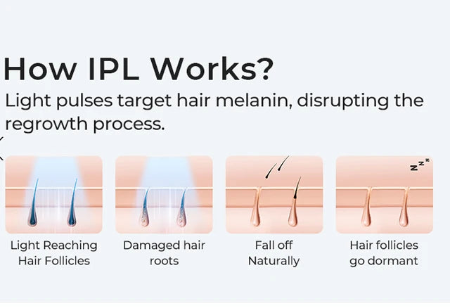 IPL Hair Removal Device - 999,999 Flashes Permanent Hair Removal Full Body Treatment
