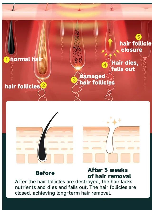 IPL Permanent Hair Removal Device - 999,999 Flashes Painless Laser Epilator for Women