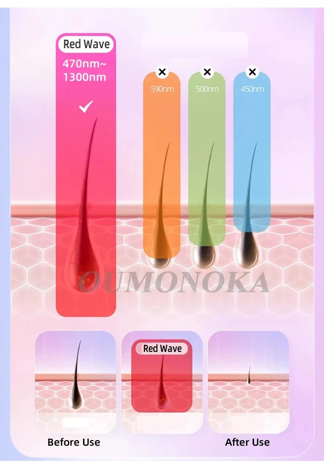 IPL Permanent Hair Removal Device - 999,999 Flashes Painless Laser Epilator for Women