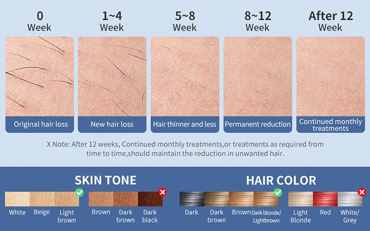 Mlay T18 Ice Cooling IPL Laser Hair Removal - Unlimited Flashes Permanent Painless Epilator for Women & Men
