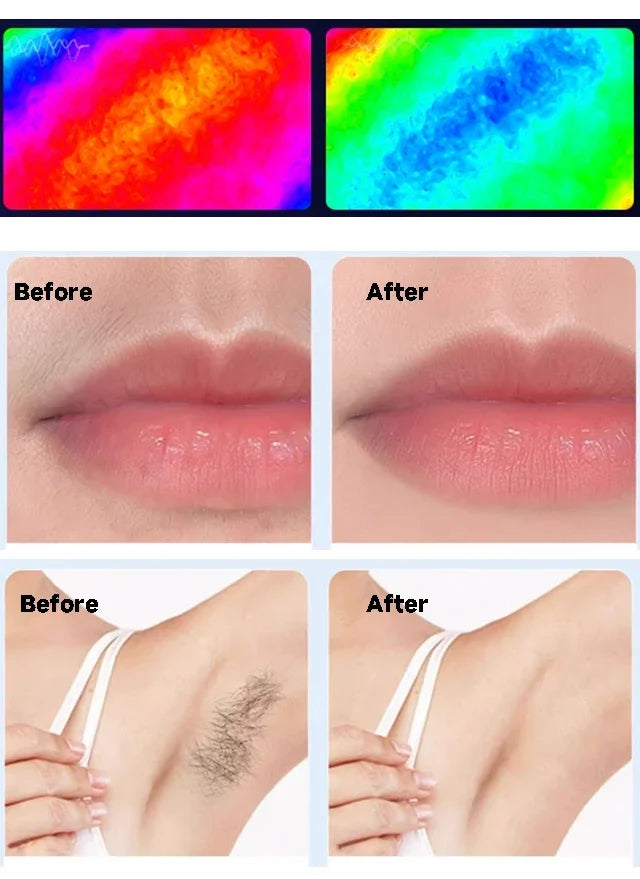 IPL Hair Removal Device - 999,999 Flashes Permanent Hair Removal Full Body Treatment