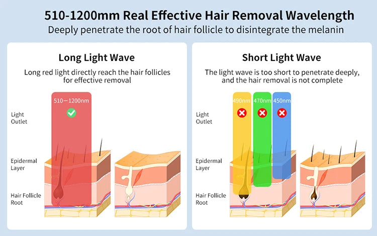 Mlay T18 Ice Cooling IPL Laser Hair Removal - Unlimited Flashes Permanent Painless Epilator for Women & Men