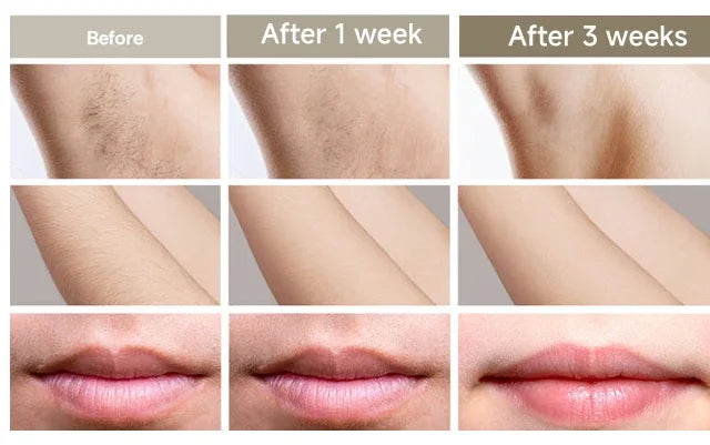 IPL Permanent Hair Removal Device - 999,999 Flashes Painless Laser Epilator for Women