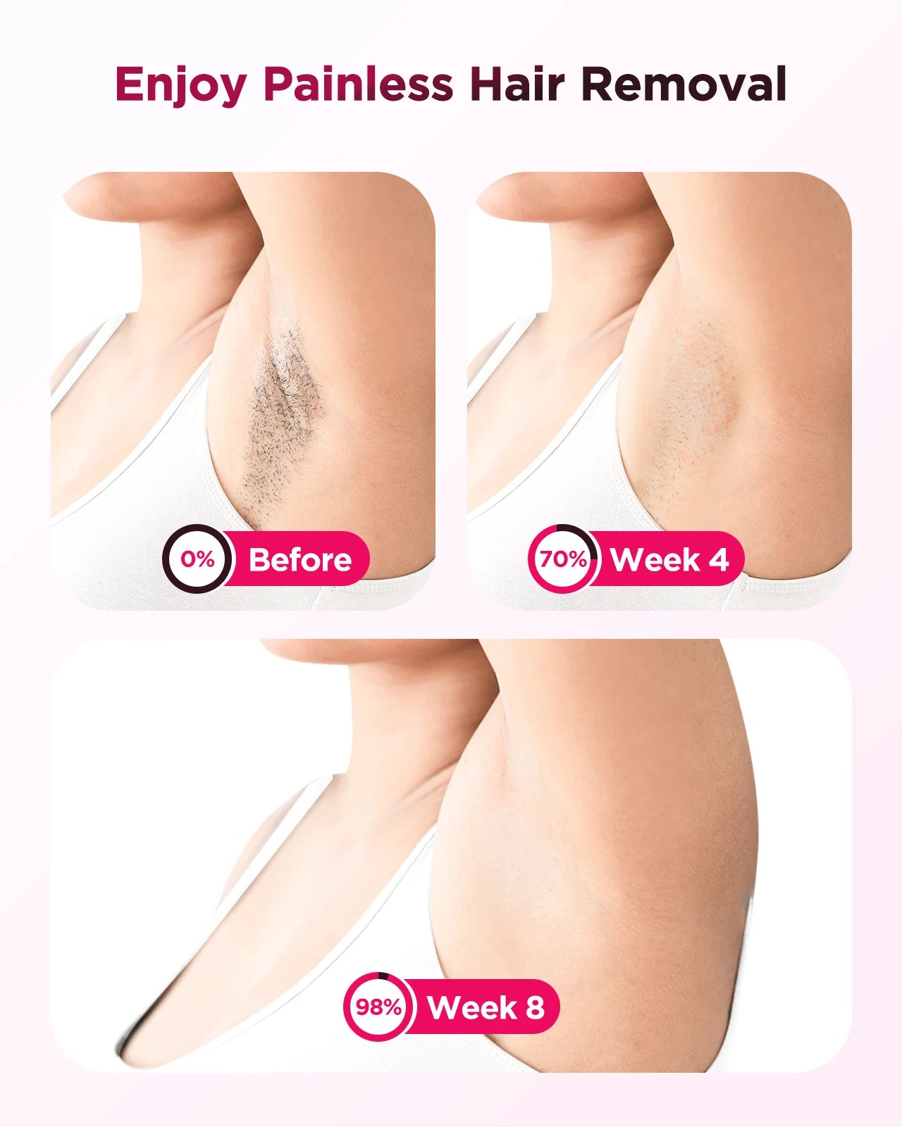 IPL hair removal device against underarm skin, white body with gold treatment window